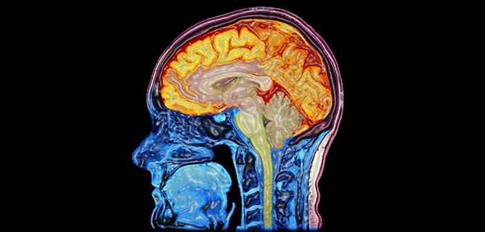 scanned image of brain inside a skull